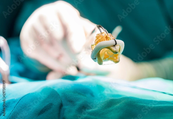 Obraz Aortic valve implant. Close up vew on artificial heart prosthesis