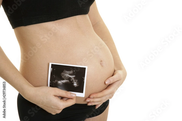 Fototapeta 20 week scan