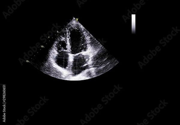 Obraz Screen of echocardiography (ultrasound) machine.