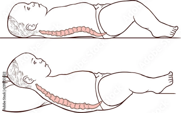 Obraz  illustration of baby spine and correct lying position