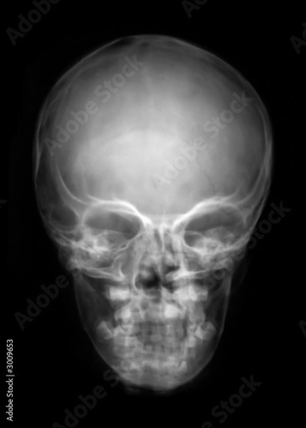 Fototapeta head from front