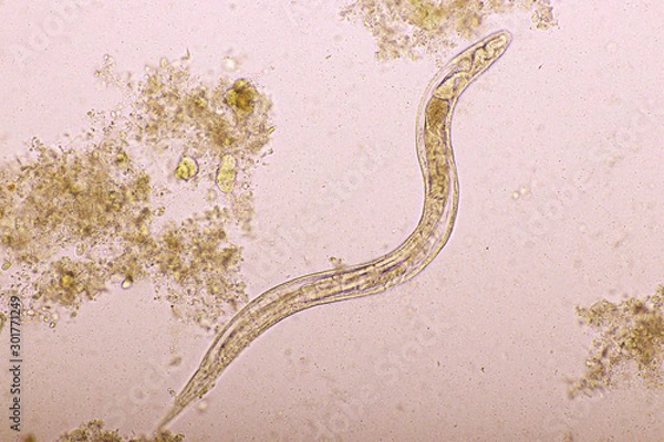 Fototapeta Strongyloides stercoralis or threadworm in human stool, analyze by microscope, original magnification 400x