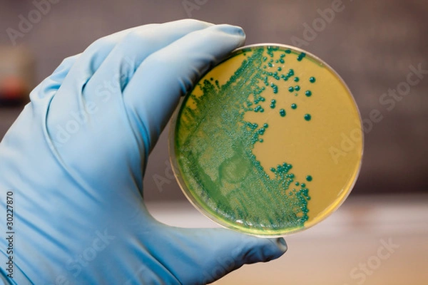 Obraz Bakterie Listeria