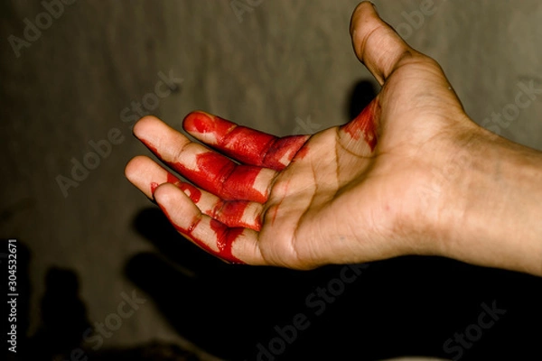 Fototapeta a badly bleeding hand and dark background 