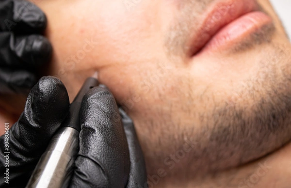 Fototapeta Male trichopigmentation service. Young man laying on the back on the esthetician table. Master hands in a black gloves holding the permanent makeup machine with the needle and touching mans hair.