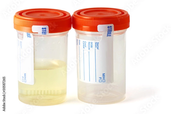 Obraz Two specimen bottles