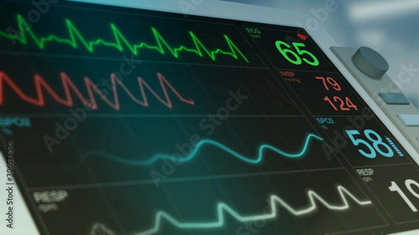 Fototapeta closeup view of an ecg ekg monitor on a operating room