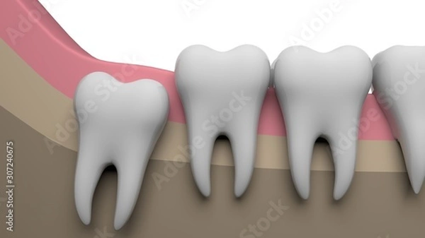 Obraz Wisdom tooth, 3D-rendering, white background