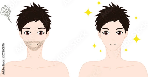 Fototapeta 男性脱毛