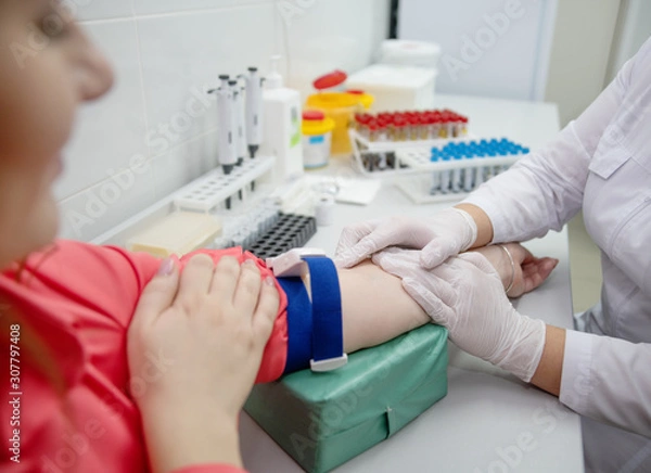 Fototapeta the young women take a blood test from the vein in the lab