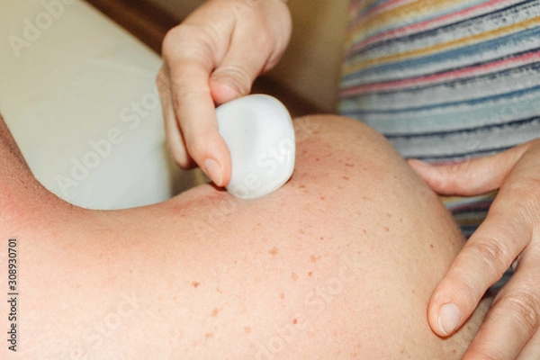 Obraz Gua sha massage. The masseuse's hands closeup. A man gets a massage.
