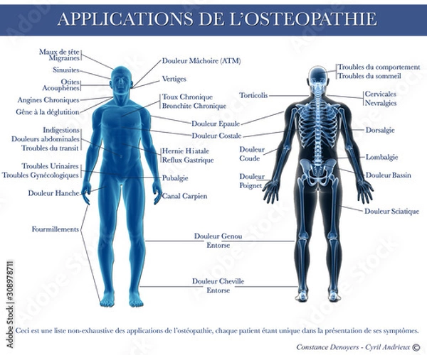 Obraz Application de l'ostéopathie