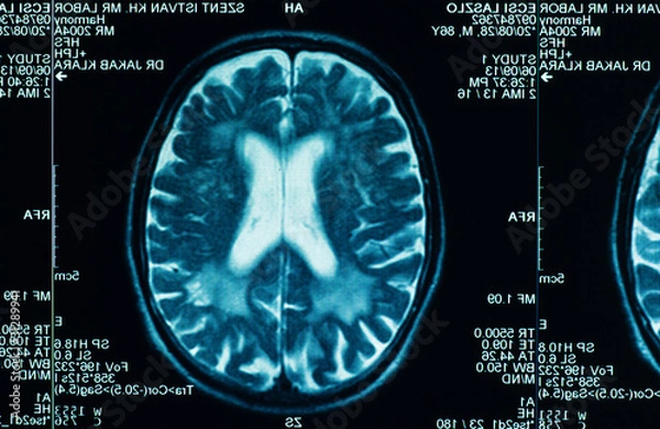 Obraz sharp ct scan of the human brain