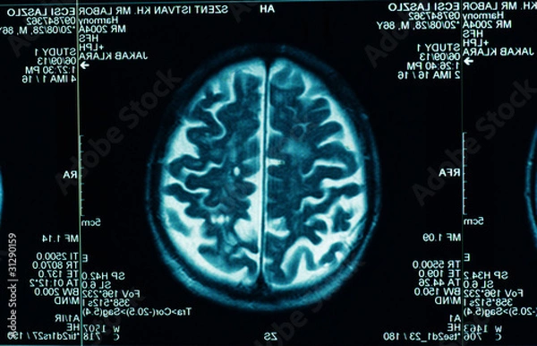 Obraz sharp ct scan of the human brain