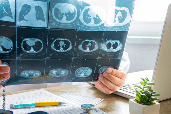 Fototapeta Doctor at appointment inspects and examines ct scan of chest and abdominal cavity. Concept photo on diagnosis of diseases in pulmonology, lung pathology, inflammatory diseases of bronchi, tuberculosis
