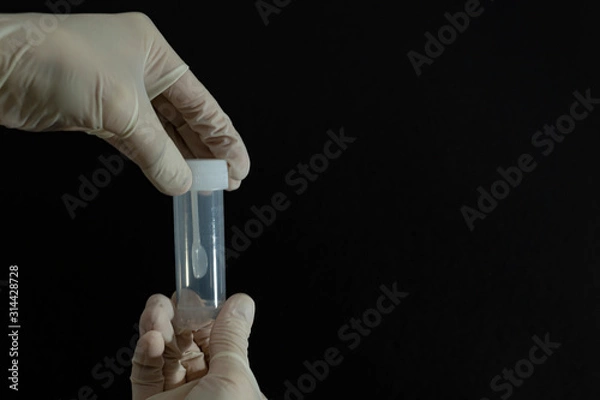 Fototapeta Female hands in white sterile medical gloves hold the lid of a sterile white plastic container or jar for stool analysis or coprology test on a black background. Horizontal close-up