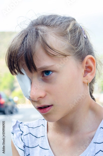 Obraz Eye injury, a little girl has a blindfolded bandaged eye with a white bandage. The pain of the child and the sadness of the child's face