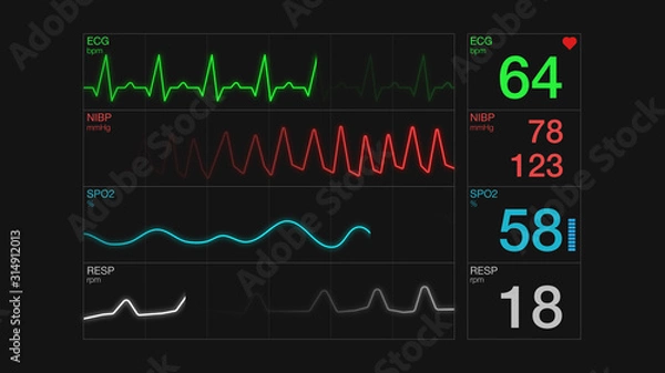 Fototapeta closeup view of an ecg ekg display