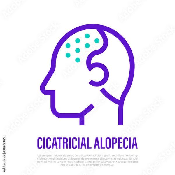 Fototapeta Cicatricial alopecia thin line icon. Hair loss. Bald place on scalp. Vector illustration.