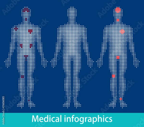 Obraz Medical infographics