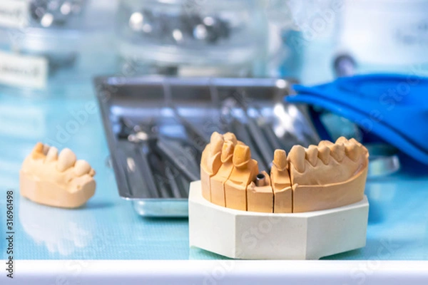 Obraz Anterior denture prosthesis for implant placement.