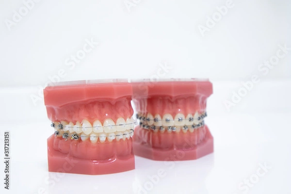 Fototapeta Close up tooth model / mock tooth in dental clinic. Mock tooth or tooth model is used by dentist to demonstrate how human teeth & jaw works. Dental care and dentist 's equipment concept. Copy space.