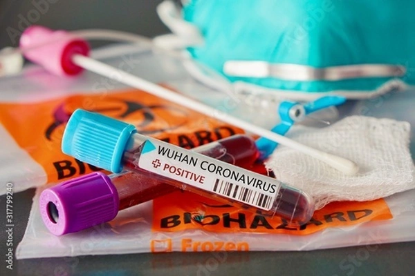 Fototapeta Positive blood test and swab result for the new rapidly spreading Coronavirus, originating in Wuhan, China with a respirator mask and biohazard bags 