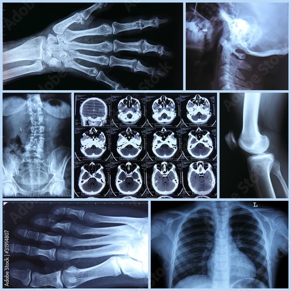 Obraz Radiography