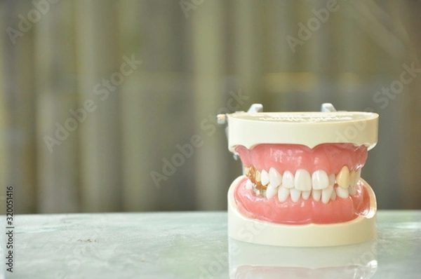 Obraz 歯列模型