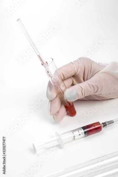 Fototapeta the gloved hand of a laboratory assistant holds a test tube with a blood sample on a white background. also in the photo is a syringe with a blood sample