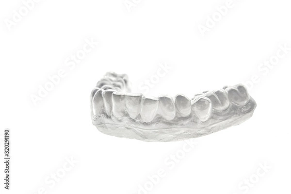 Obraz Bleaching orthodontics tray for teeth on gypsum model