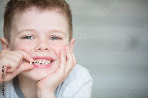 Obraz Teenager child with a tooth dropped out