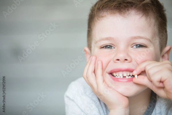 Obraz Teenager child with a tooth dropped out