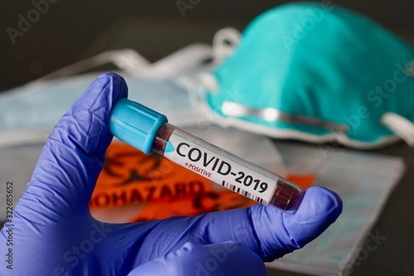 Fototapeta COVID-2019, the name chosen by WHO for the new rapidly spreading Coronavirus outbreak that originated in Wuhan, China