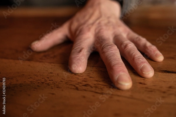 Obraz The amputated hand of a carpenter