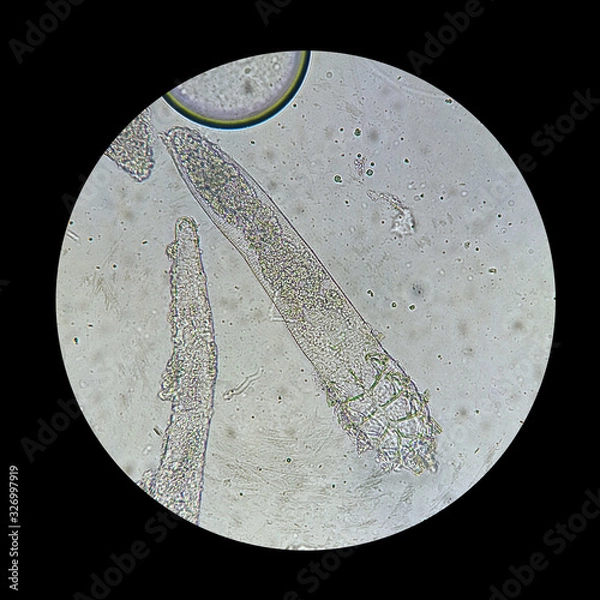 Fototapeta Demodex mite from a microscope view. The parasite causing a skin disease -Demodecosis.