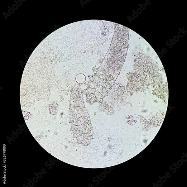 Fototapeta Demodex mite from a microscope view. The parasite causing a skin disease -Demodecosis.