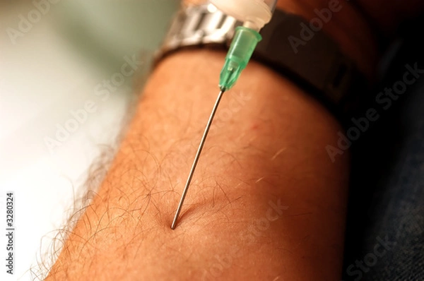 Obraz needle
