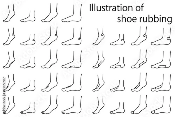 Obraz 靴擦れのイラストセット１