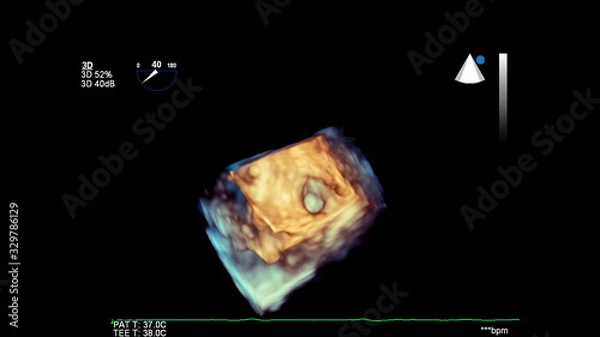 Fototapeta 3D image of the heart during transesophageal ultrasound of the heart.