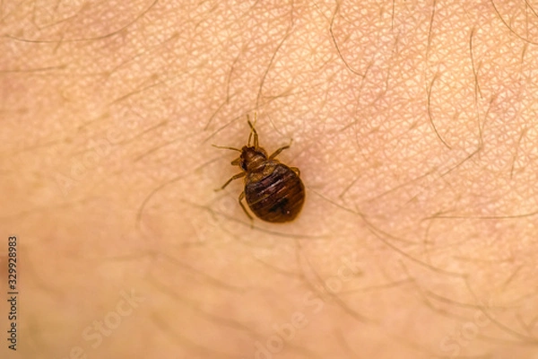 Obraz Bed Bug On Skin 