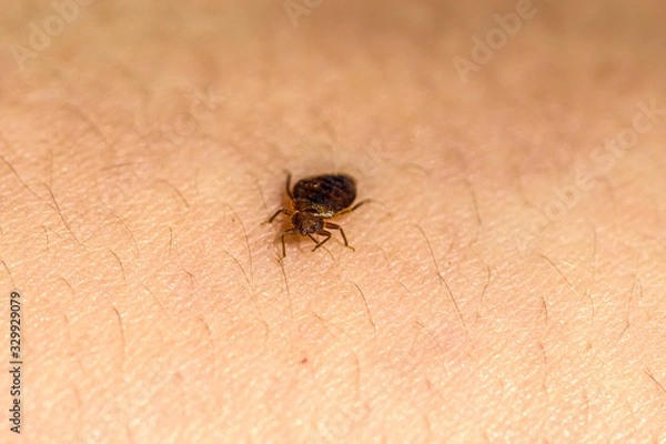 Fototapeta Bed Bug Up Close 