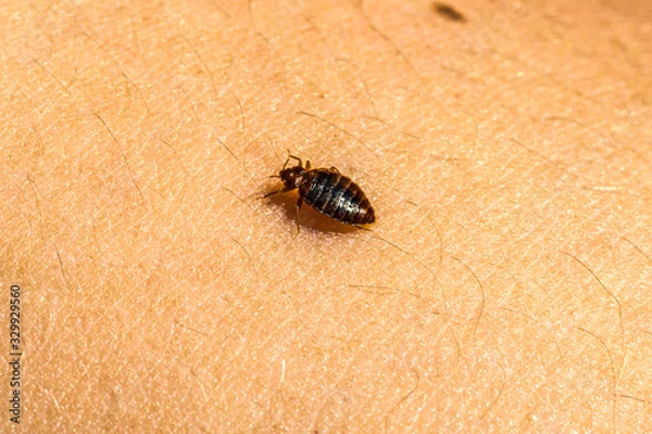 Obraz Bed Bug On Skin 