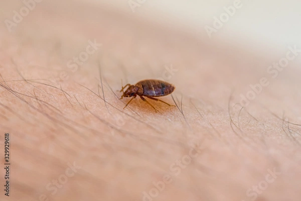 Fototapeta Bed Bug On Skin 