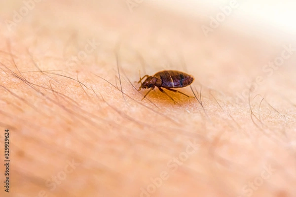 Fototapeta Bed Bug On Skin 