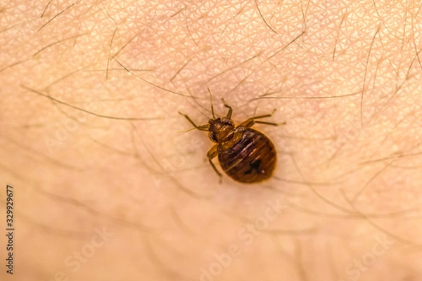 Fototapeta Bed Bug On Skin 