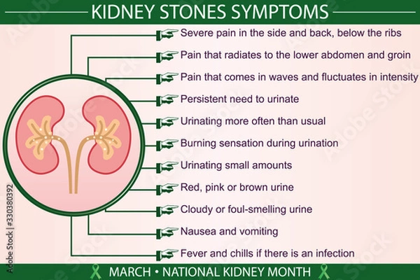 Fototapeta Kidney stones disease symptoms infographic. Health, and march national kidney month concept. For presentation, banner, brochure. An illustration prepared in eps 10 file format.
