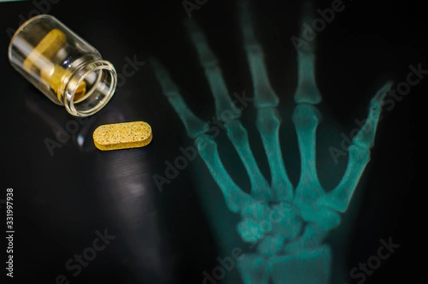 Obraz medical suggestions and pharmaceuticals
