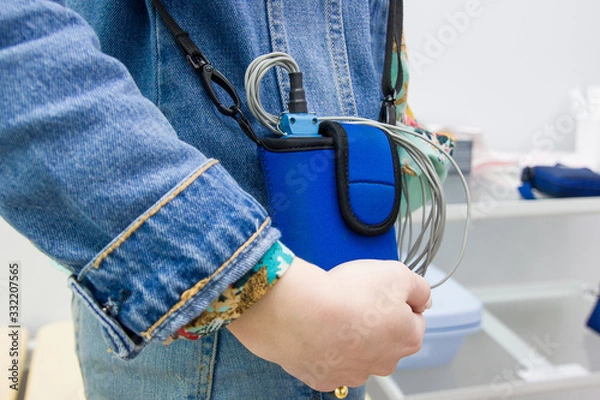 Fototapeta A girl holds halter to monitor the ECG of the heart in the cardiology clinic. Close-up