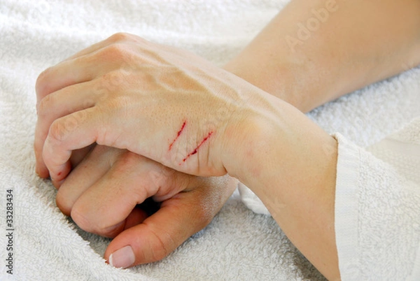 Obraz Scratched arms